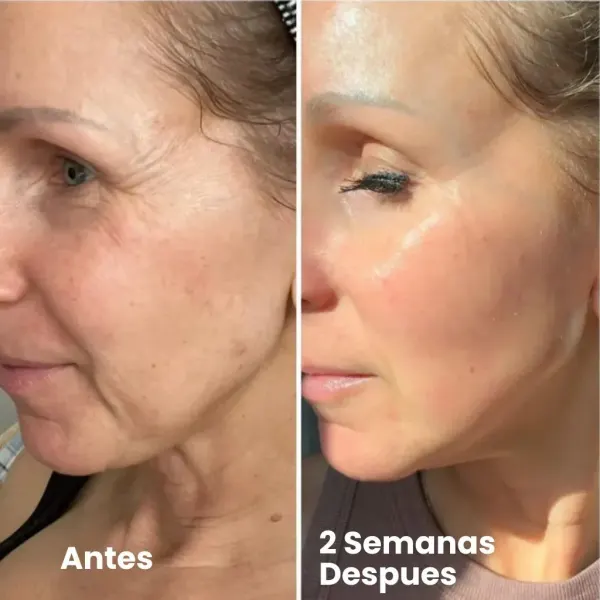 Sérum Retinal Shot Fiorea para reafirmar y reducir arrugas