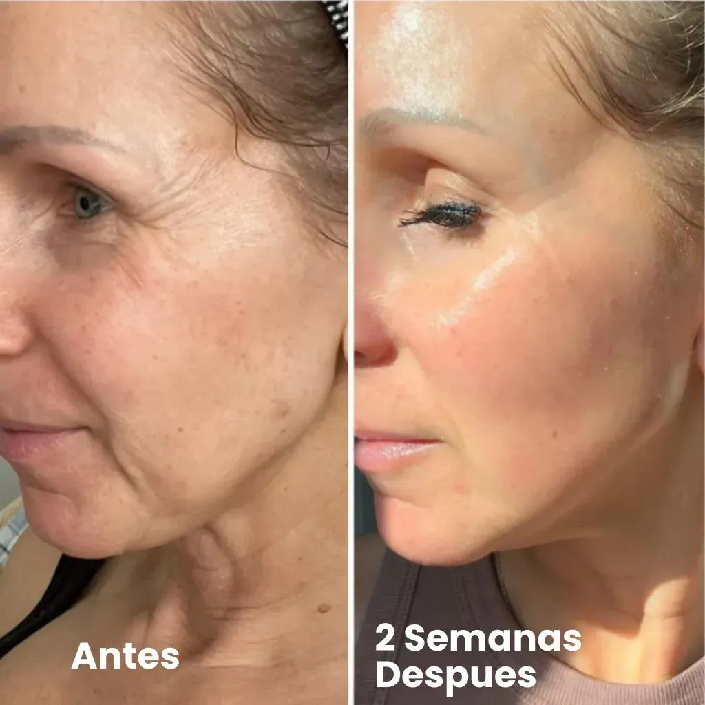 Sérum Retinal Shot Fiorea para reafirmar y reducir arrugas